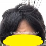 下り坂を下りた後の髪型