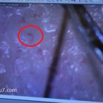 スコープで頭皮の血流の状態を見ている様子